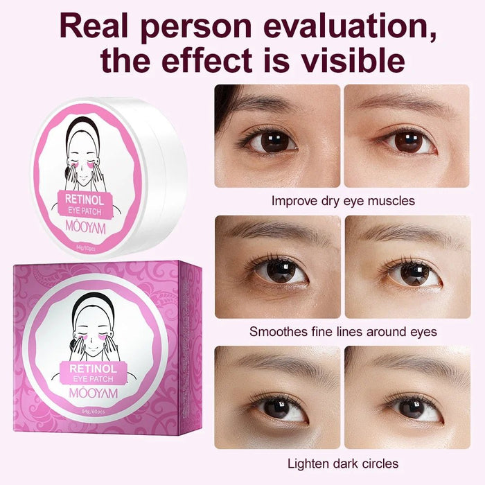 Mooyam Mascarilla para el contorno de ojos, 30 pares de mascarillas de retinol - Quierox - Tienda Online