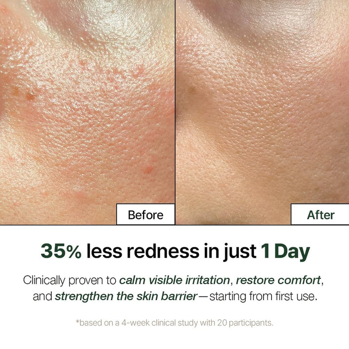 NDP Cica Cream - Crema hidratante facial de gel para aliviar quemaduras solares - Quierox - Tienda Online