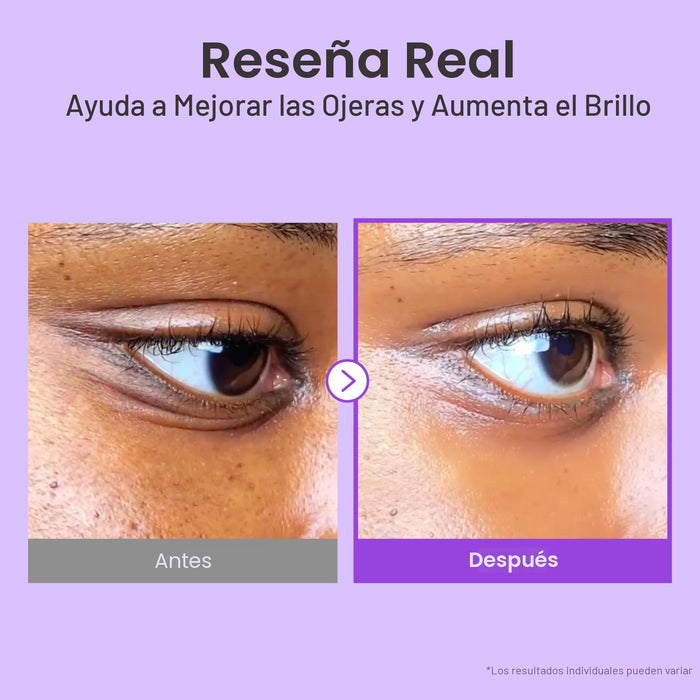 numbuzin No.9 NAD+ Retinol Crema de ojos desinflamante y reafirmante para ojeras - Quierox - Tienda Online