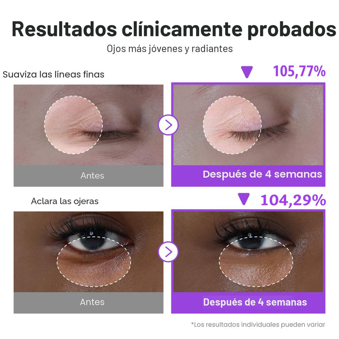 numbuzin No.9 NAD+ Retinol Crema de ojos desinflamante y reafirmante para ojeras - Quierox - Tienda Online