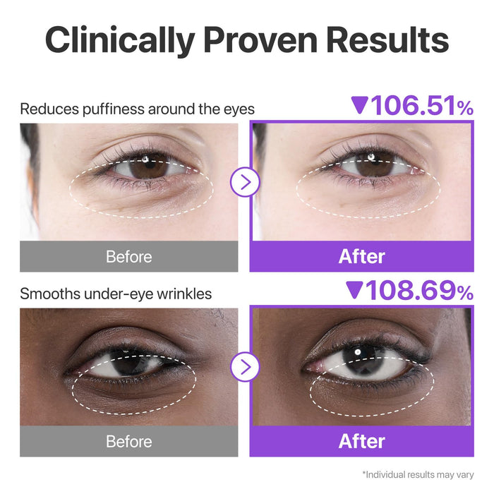 numbuzin No.9 Parches para ojos, mascarillas de gel de colágeno NAD+ con péptidos - Quierox - Tienda Online