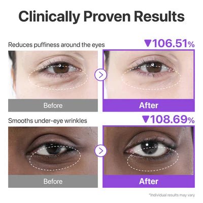 Numbuzin Parches de colágeno NAD+ n.° 9 para el contorno de ojos (5 pares) - Quierox - Tienda Online