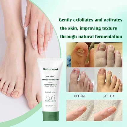 Nutraboost Gel natural para el cuidado de uñas, suero fortalecedor - Quierox - Tienda Online