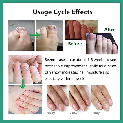 Nutraboost Gel natural para el cuidado de uñas, suero fortalecedor - Quierox - Tienda Online