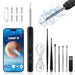 Otoscopio limpiador de oídos, 1296P HD, 3,6 mm, WiFi,compatible con Android e iOS (negro) - Quierox - Tienda Online