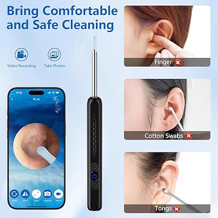 Otoscopio limpiador de oídos, 1296P HD, 3,6 mm, WiFi,compatible con Android e iOS (negro) - Quierox - Tienda Online