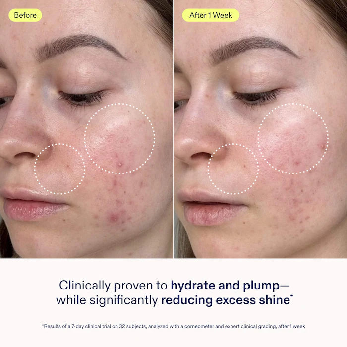 SKINFIX Crema en gel restauradora de la barrera cutánea con niacinamida y péptidos