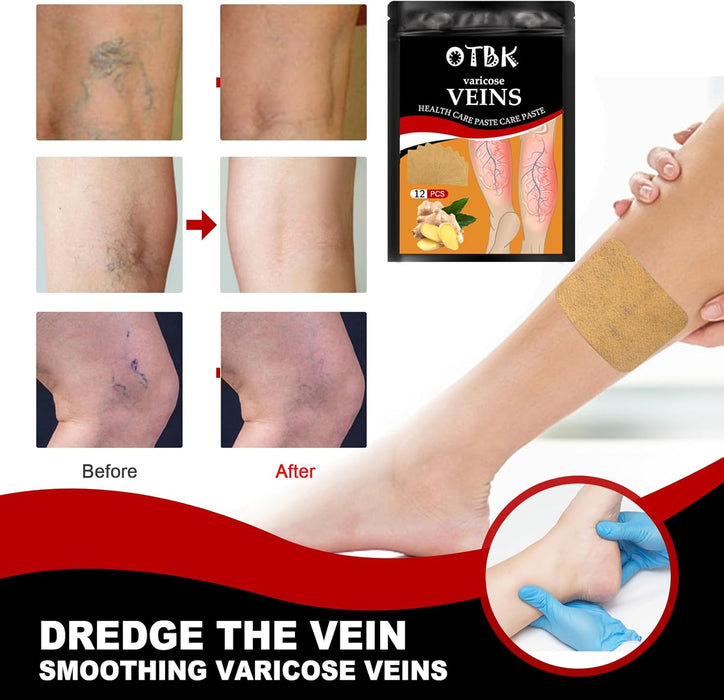 Parche para venas varicosas (36 piezas) - Alivia naturalmente las venas varicosas en piernas - Quierox - Tienda Online