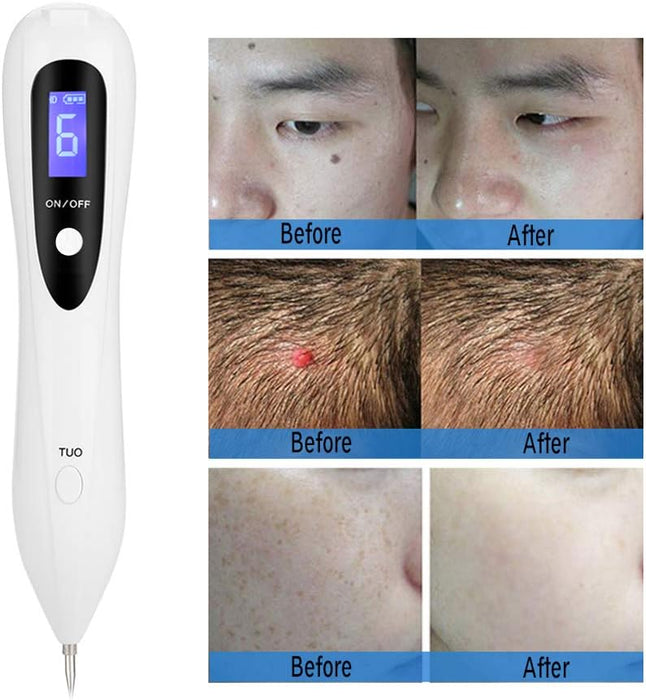 Pluma de plasma My-035 - Quierox - Tienda Online