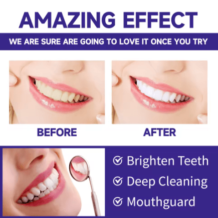 Polvo blanqueador dental para limpieza profunda de dientes, eliminación de manchas - Quierox - Tienda Online
