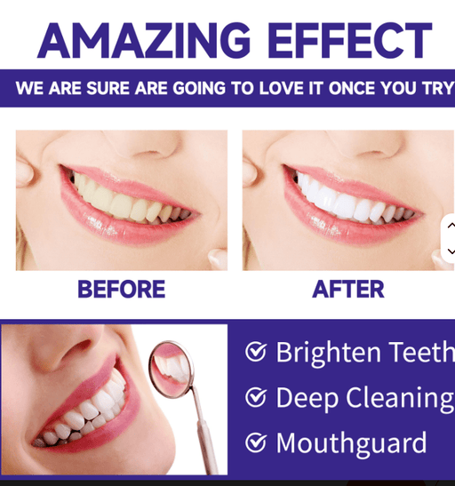 Polvo blanqueador dental para limpieza profunda de dientes, eliminación de manchas - Quierox - Tienda Online