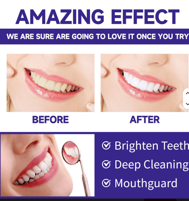 Polvo blanqueador dental para limpieza profunda de dientes, eliminación de manchas - Quierox - Tienda Online