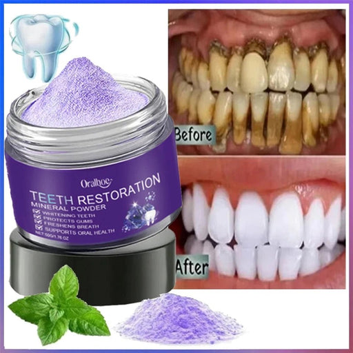 Polvo mineral para la restauración dental Oralhoe 50 g - Quierox - Tienda Online