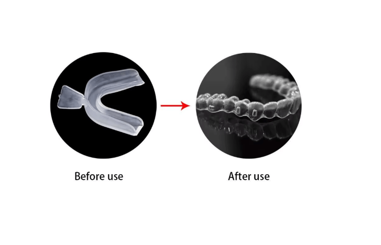 Protector de dientes para ayuda al sueño, Protector bucal, para blanquear los dientes - Quierox - Tienda Online