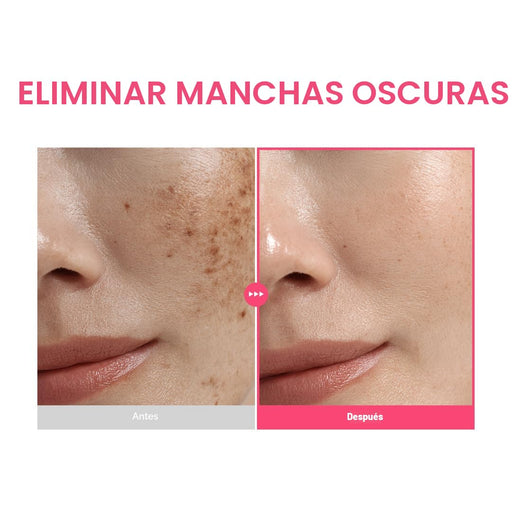 PURITO TXA 6% + Niacinamida 10% + Retinal Suero Facial | para manchas oscuras - Quierox - Tienda Online