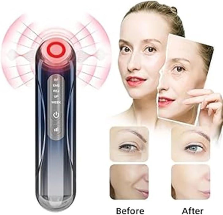 Radiance ONE Handset Dispositivo de rejuvenecimiento antiedad para uso doméstico, masajeador facial de alta frecuencia - Quierox - Tienda Online