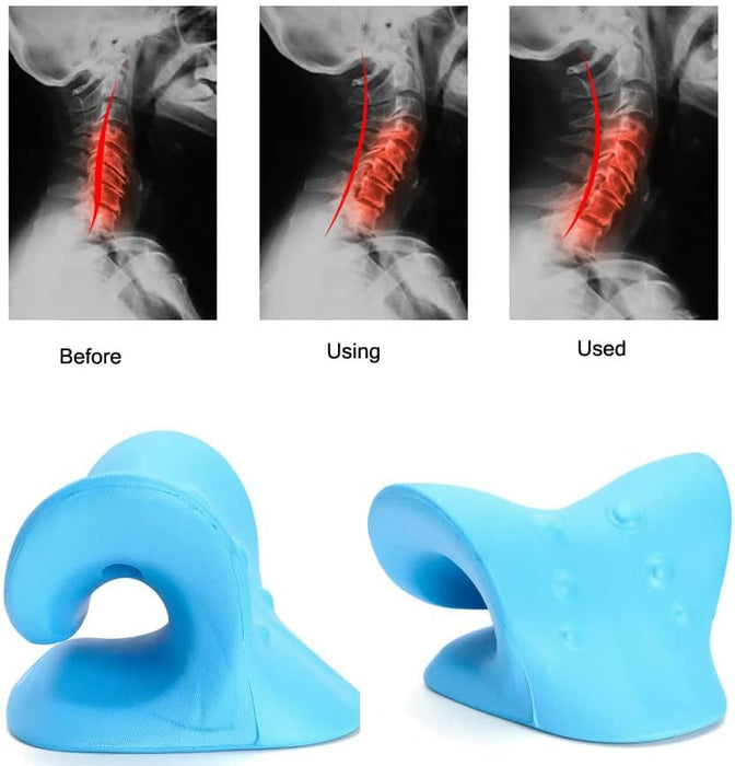 Relajante de cuello y hombros, dispositivo de tracción de masaje de vértebras cervicales para aliviar el dolor de ATM - Quierox - Tienda Online