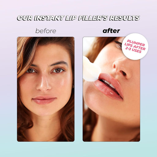 Relleno de labios instantáneo para labios carnosos en 30 minutos de Vitamasques, pack de 3 - Quierox - Tienda Online