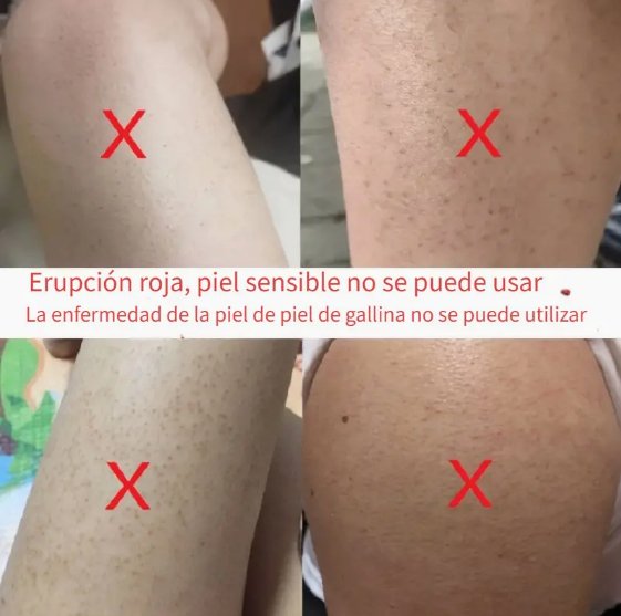 Removedor de vello de brazos y piernas, reutilizable y lavable, portátil, 1 pieza - Quierox - Tienda Online