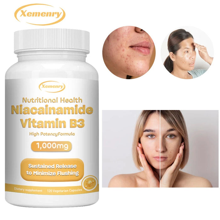 Niacinamida Vitamina B3 1000 mg - Antienvejecimiento, Aclara el tono de la piel