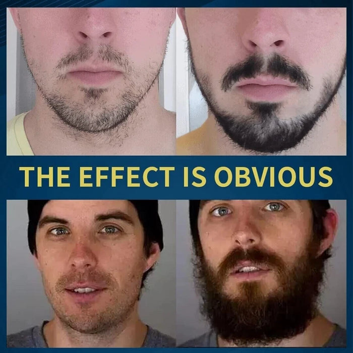 Aceite para el crecimiento de la barba con 5 % de minoxidil + sérum para el crecimiento
