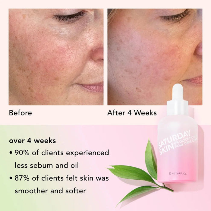 Saturday skin Tratamiento activo para poros 50 ml - Quierox - Tienda Online