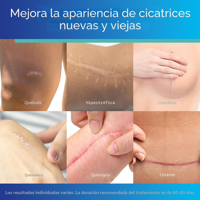 ScarAway, láminas de silicona transparentes avanzadas para cicatrices - Quierox - Tienda Online