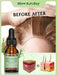 Shein Aceite esencial de romero para cabello y cuero cabelludo Slow Sunday 15ml - Quierox - Tienda Online