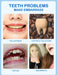 SHEIN Polvo para blanquear los dientes, menta, deshacerse de las manchas - Quierox - Tienda Online