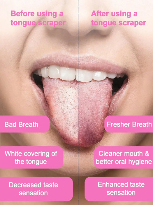 Shein Raspador de lengua en forma de U para adultos - Quierox - Tienda Online