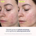 SKINFIX Crema en gel restauradora de la barrera cutánea con niacinamida y péptidos - Quierox - Tienda Online