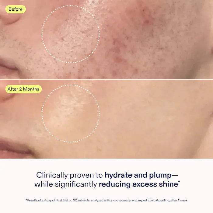 SKINFIX Crema en gel restauradora de la barrera cutánea con niacinamida y péptidos - Quierox - Tienda Online