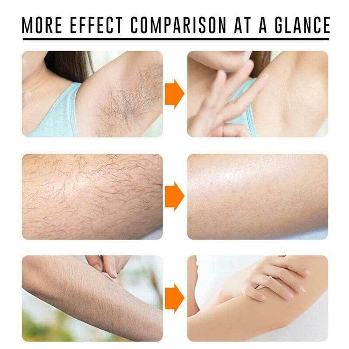 Spray de depilación permanente 100% natural para detener el crecimiento del cabello - Quierox - Tienda Online