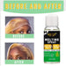 Spray de fusión de encaje, adhesivo para el cabello sin pegamento para pelucas y extensiones - Quierox - Tienda Online