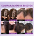Spray Minoxidil 5% Crecimiento Sérum Para Cabello Y Barba - Quierox - Tienda Online