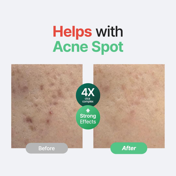 Suero sin perfume de centella PURITO, 34 860 ppm de centella - Quierox - Tienda Online