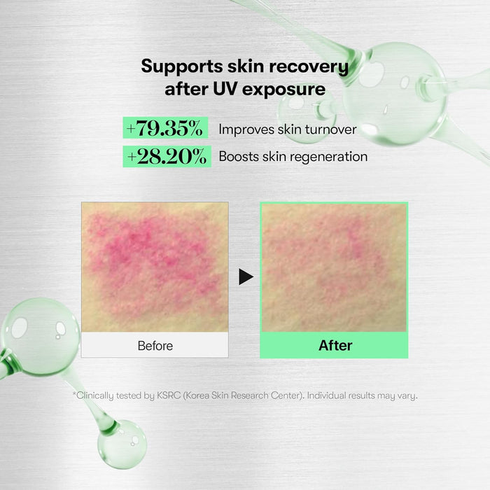 Suero VT Centella Asiatica Microneedle 700 (30g) - Quierox - Tienda Online