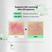 Suero VT Centella Asiatica Microneedle 700 (30g) - Quierox - Tienda Online
