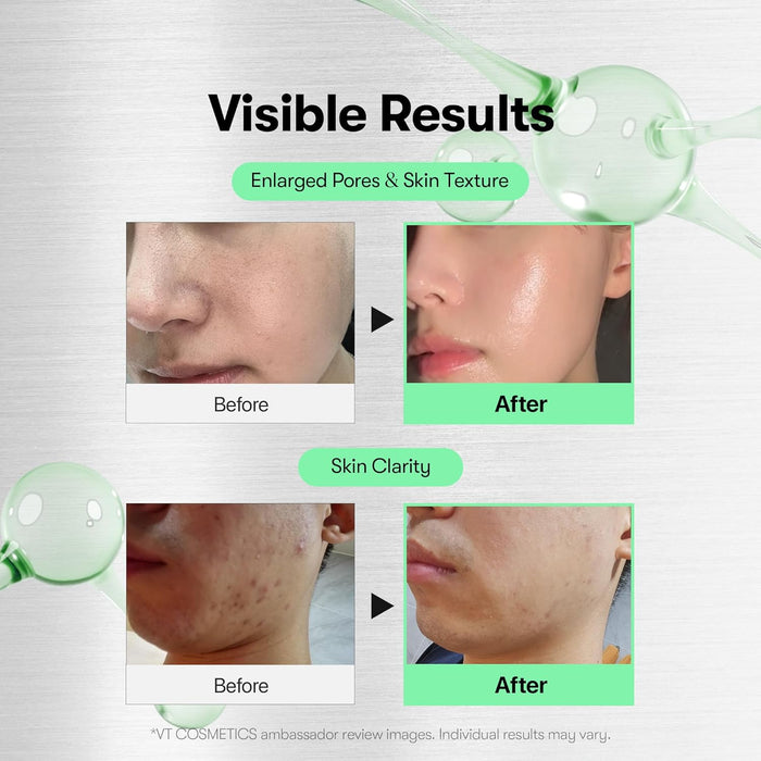 Suero VT Centella Asiatica Microneedle 700 (30g) - Quierox - Tienda Online