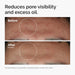 The Ordinary Niacinamida 10% + Zinc 1%, Suero suavizante - Quierox - Tienda Online