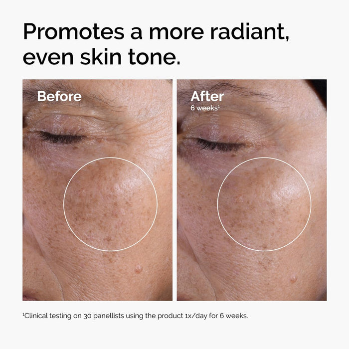 The Ordinary Tónico exfoliante de ácido glicólico al 7%, tóner diario iluminador y suavizante - Quierox - Tienda Online