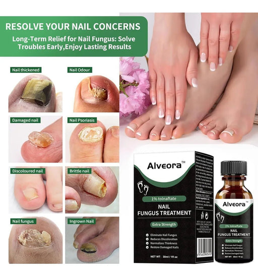 Tratamiento extra fuerte para hongos en las uñas de los pies. Reparación de las uñas de los pies. - Quierox - Tienda Online