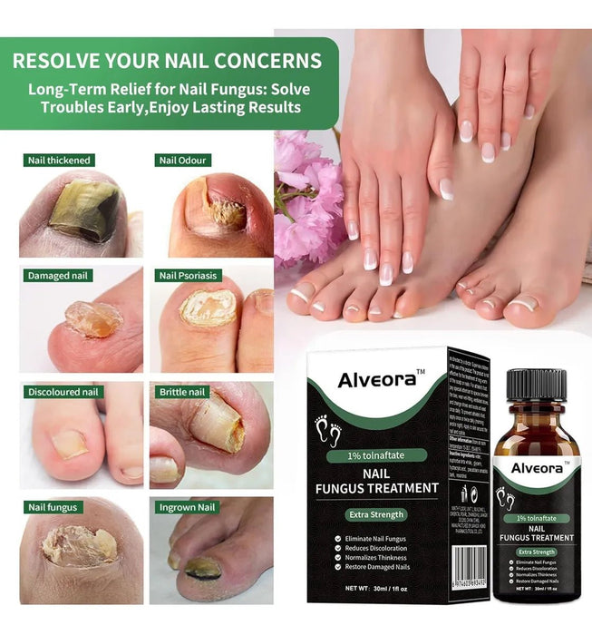 Tratamiento extra fuerte para hongos en las uñas de los pies. Reparación de las uñas de los pies. - Quierox - Tienda Online