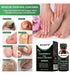 Tratamiento extra fuerte para hongos en las uñas de los pies. Reparación de las uñas de los pies. - Quierox - Tienda Online