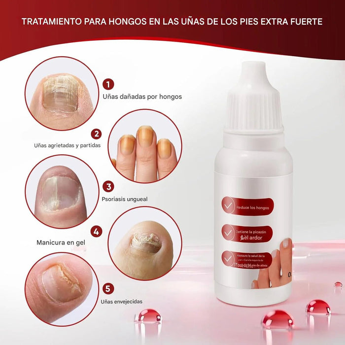 Tratamiento para Uñas de los Pies, Fungi Nail - Quierox - Tienda Online