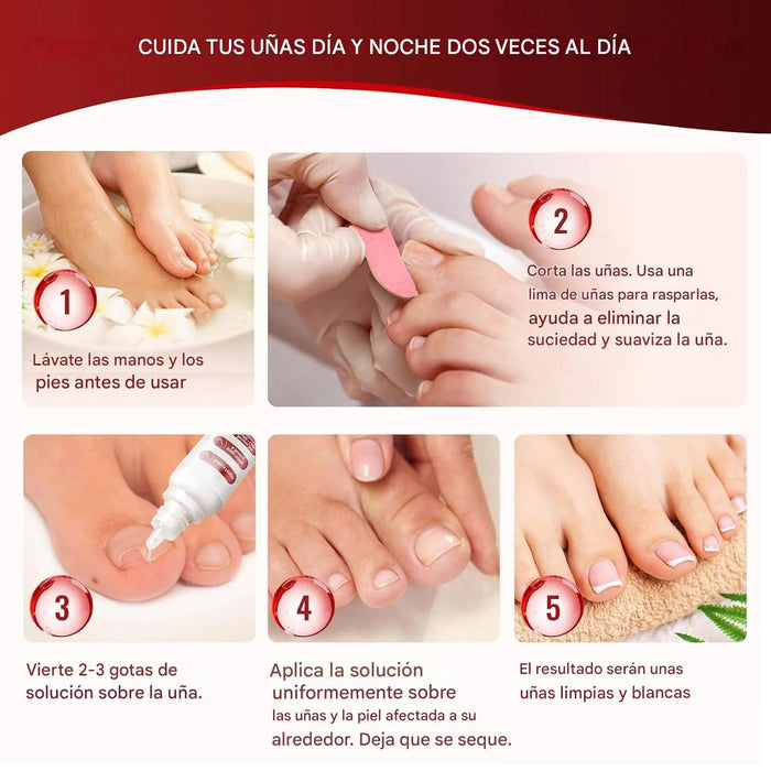 Tratamiento para Uñas de los Pies, Fungi Nail - Quierox - Tienda Online