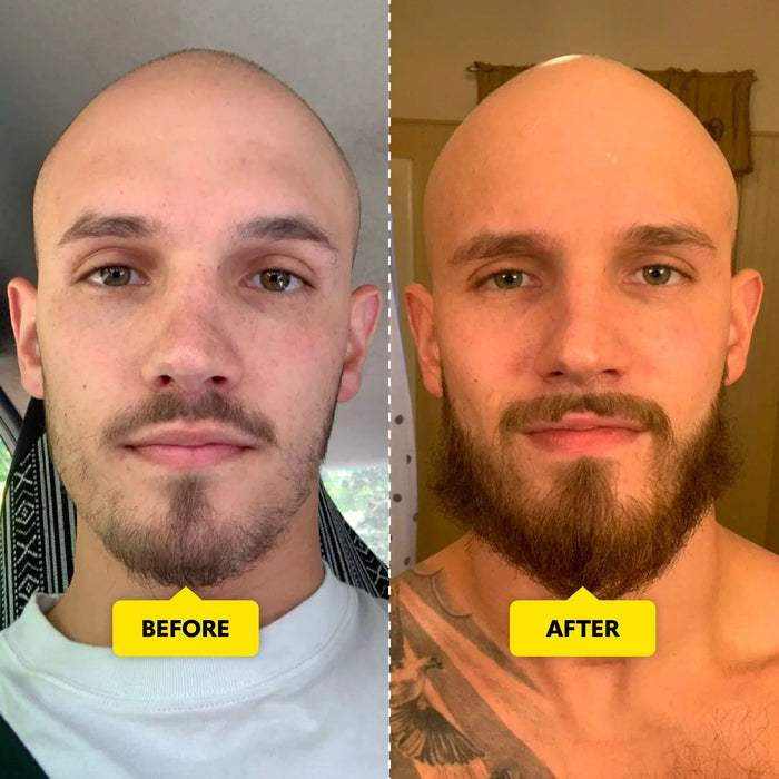 Vitaminas para el crecimiento de la barba - Quierox - Tienda Online