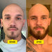 Vitaminas para el crecimiento de la barba - Quierox - Tienda Online