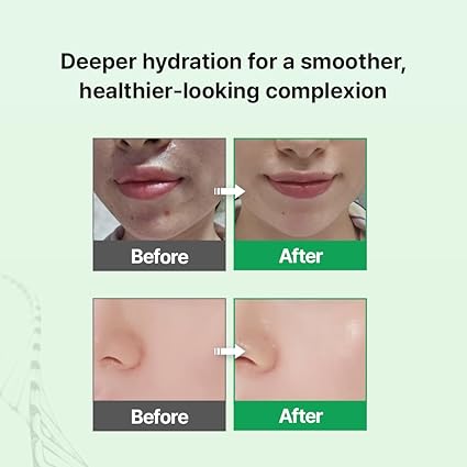 [zipiderm] Ampolla hidratante barrera cutánea con EGF 30 ml - Quierox - Tienda Online
