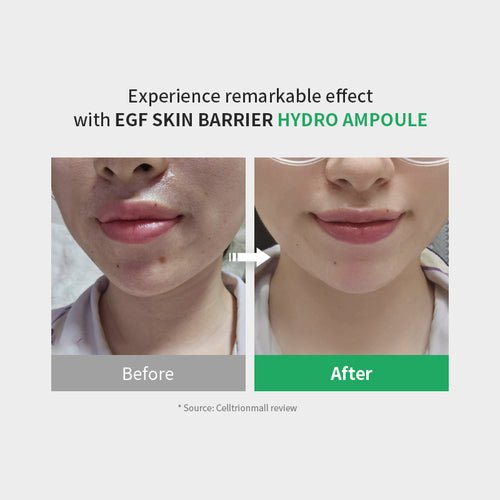 [zipiderm] Ampolla hidratante barrera cutánea con EGF 30 ml - Quierox - Tienda Online